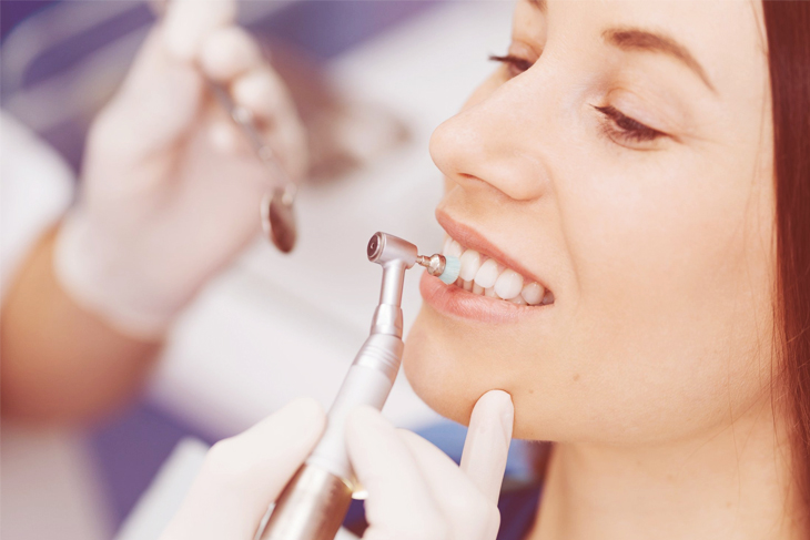 dental fillings lancaster tx